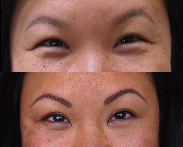 Permanent Makeup Correction What to Do About a Bad Eyebrow Tattoo